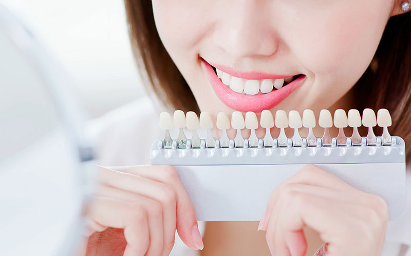 ホワイトニング